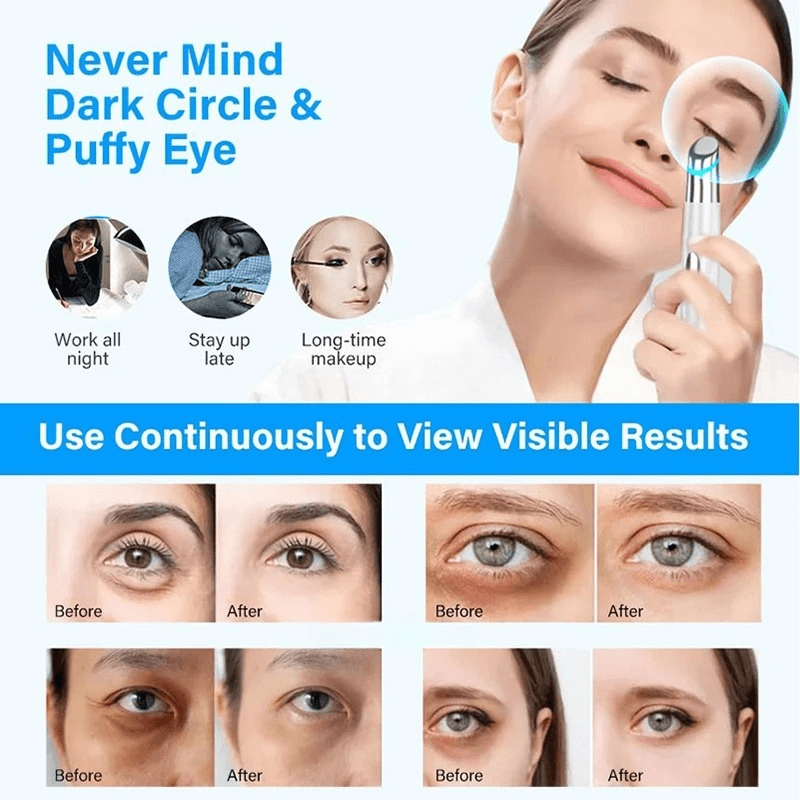 EyeGlow™ Puffiness & Dark Circle Remover