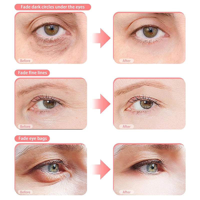 VisionLift™ EMS Eye Glasses | Reduce Eye Bags, Wrinkles & Fatigue